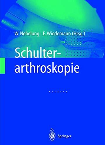 Schulterarthroskopie