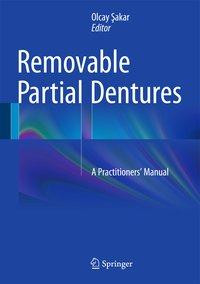 Removable Partial Dentures