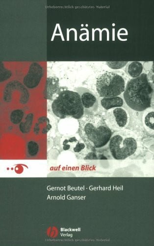 Anämie auf einen Blick.