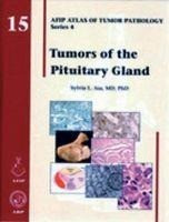 Asa, S: Tumors of the Pituitary Gland