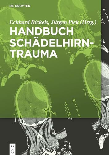 Handbuch Schädelhirntrauma