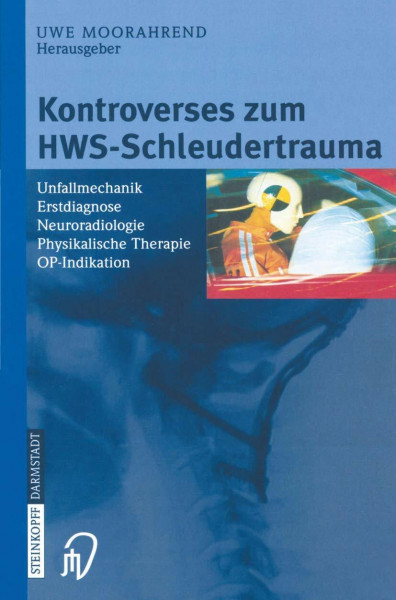 Kontroverses zum HWS-Schleudertrauma. Unfallmechanik, Erstdiagnose, Neuroradiologie, Physikalische Therapie, OP-Indikation