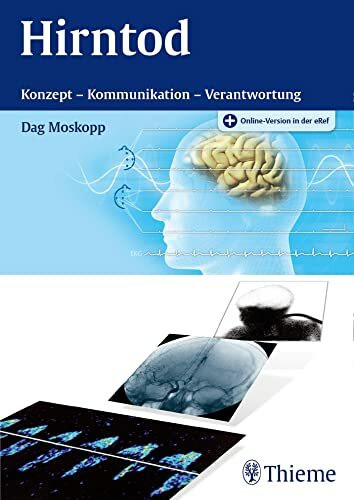 Hirntod: Konzept - Kommunikation - Verantwortung