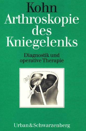 Arthroskopie des Kniegelenks. Diagnostik und operative Therapie.