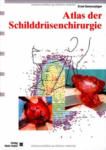 Atlas der Schilddrüsenchirurgie: Ein chirurgisch-klinisches Lehrbuch Atlas der Schilddrüsenchirurgie: Ein chirurgisch-klinisches Lehrbuch