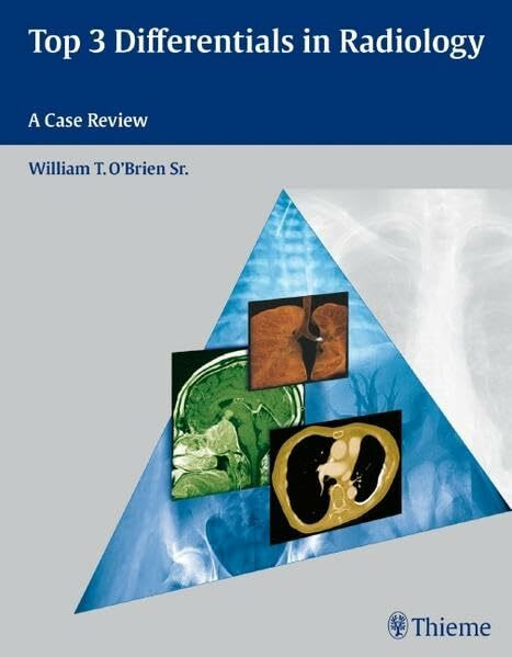 Top 3 Differentials in Radiology: A Case Review