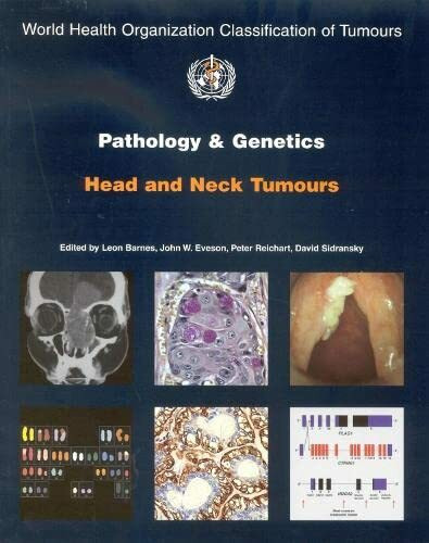 Pathology And Genetics of Head and Neck Tumours (World Health Organization Classification of Tumours)