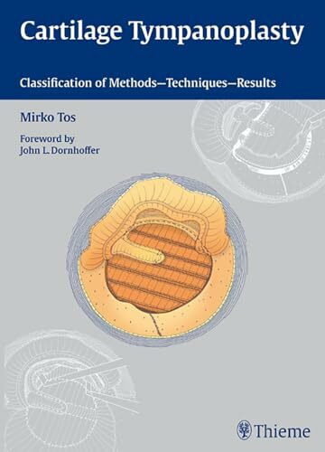 Cartilage Tympanoplasty: Classification of Methods - Techniques - Results