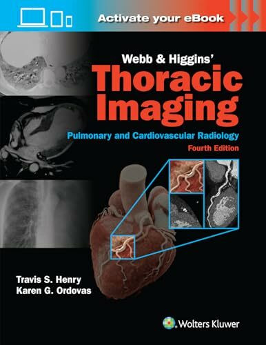 Webb & Higgins Thoracic Imaging: Print + eBook with Multimedia