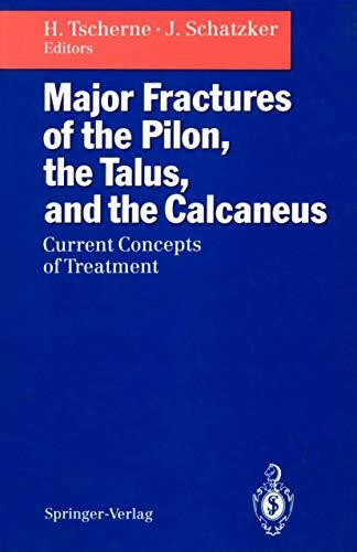 Major Fractures of the Pilon, the Talus, and the Calcaneus: Current Concepts of Treatment