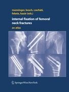 Internal fixation of femoral neck fractures
