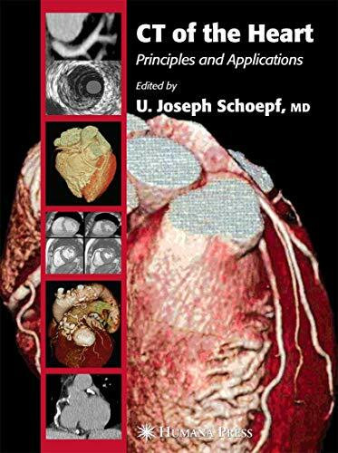 CT of the Heart: Principles and Applications (Contemporary Cardiology)