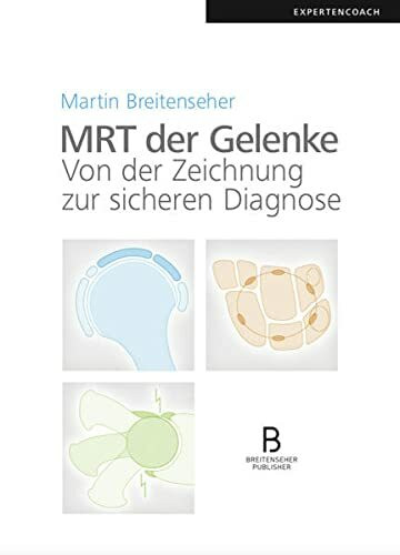 MRT der Gelenke: Von der Zeichnung zur sicheren Diagnose