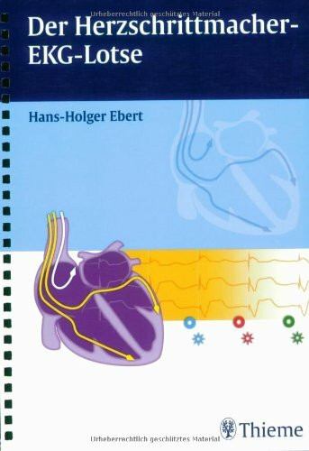 Der Herzschrittmacher-EKG-Lotse