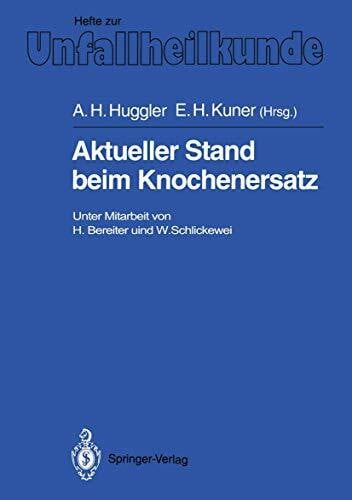 Aktueller Stand Beim Knochenersatz (Hefte zur Zeitschrift "Der Unfallchirurg") (German Edition) (Hefte zur Zeitschrift "Der Unfallchirurg", 216, Band 216)