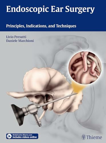 Endoscopic Ear Surgery: Principles, Indications, and Techniques