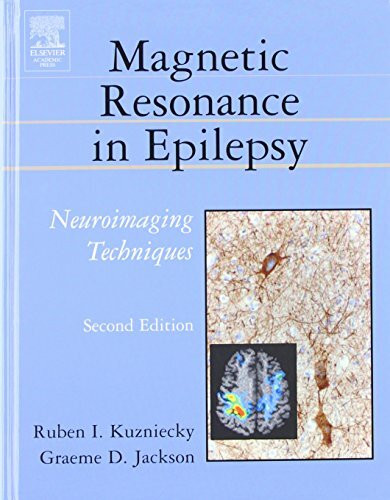 Magnetic Resonance in Epilepsy: Neuroimaging Techniques, Second Edition
