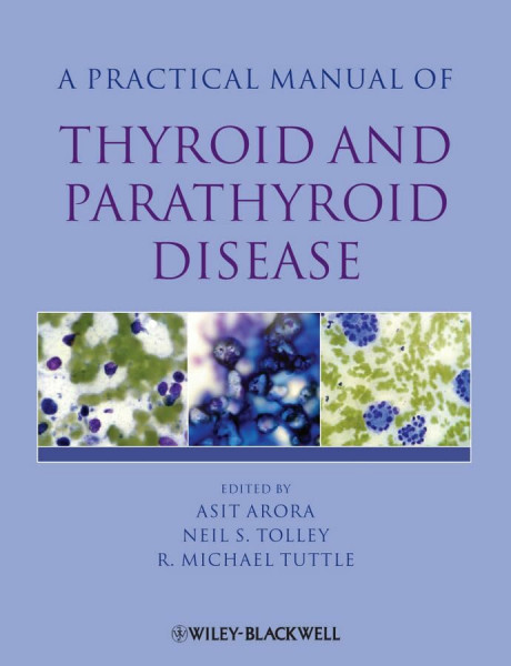 Practical Manual of Thyroid and Parathyroid Disease (Practical Manual of Series)