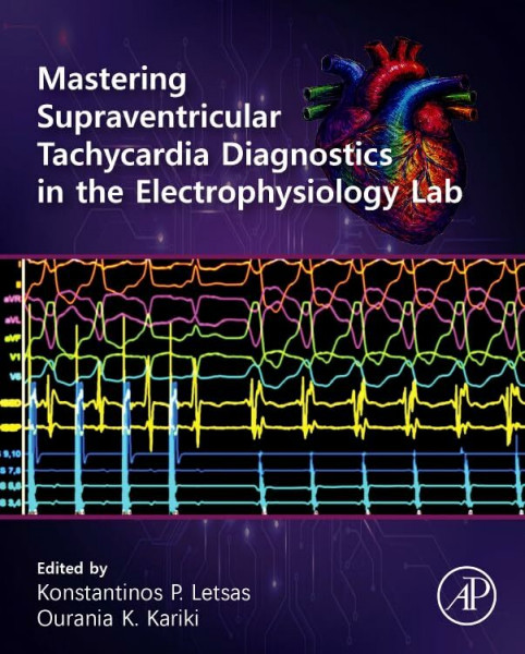 Mastering Supraventricular Tachycardia Diagnostics in the Electrophysiology Lab