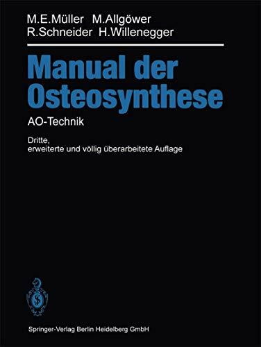 Manual der OSTEOSYNTHESE: AO-Technik