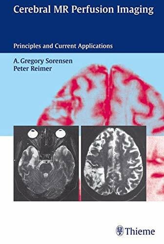Cerebral MR Perfusion Imaging: Principles and Current Applications