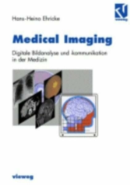 Medical Imaging: Digitale Bildanalyse und -kommunikation in der Medizin