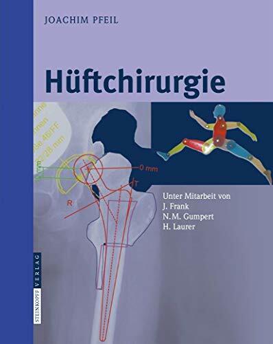 Hüftchirurgie Hüftchirurgie