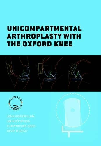 Unicompartmental Arthroplasty With the Oxford Knee