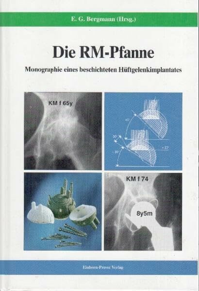 Die RM-Pfanne: Monographie eines beschichteten Hüftgelenkimplantates