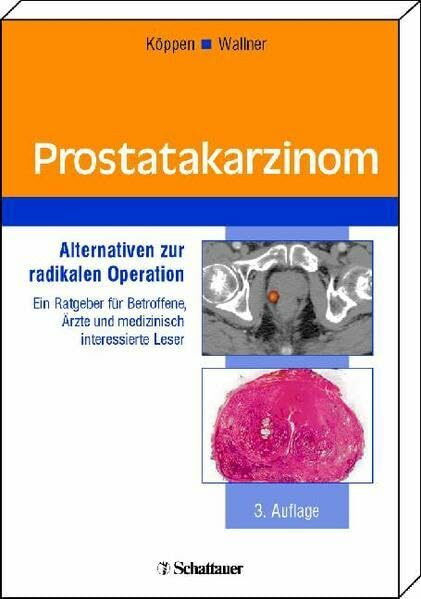 Prostatakarzinom: Alternativen zur radikalen Operation Ein Ratgeber für Betroffene, Ärzte und medizinisch interessierte Leser