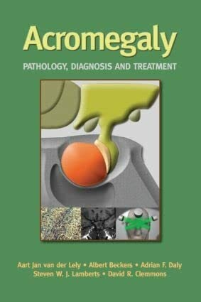 Acromegaly: Pathology, Diagnosis And Treatment