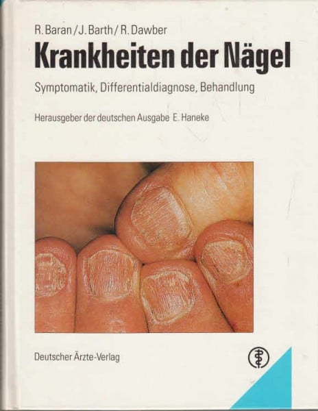 Krankheiten der Nägel: Symptomatik, Differentialdiagnose, Behandlung