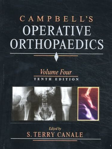 Campbell's Operative Orthopaedics, 4 Vols