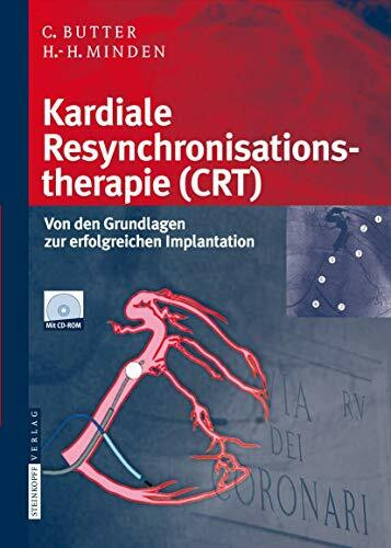 Kardiale Resynchronisationstherapie (CRT): Von den Grundlagen zur erfolgreichen Implantation