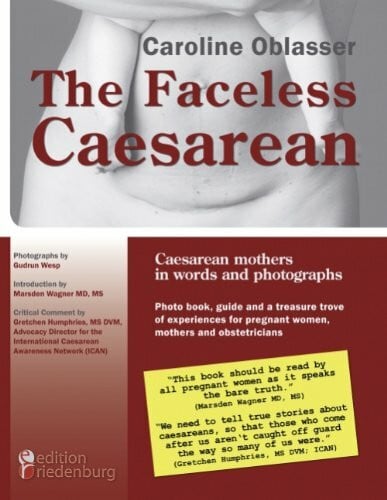 The Faceless Caesarean - Caesarean mothers in words and photographs. Photo book, guide and a treasure trove of experienc
