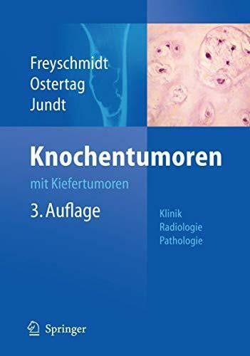 Knochentumoren mit Kiefertumoren: Klinik - Radiologie - Pathologie