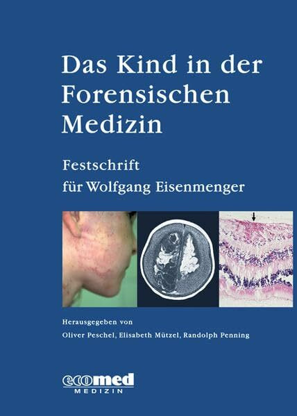 Das Kind in der Forensischen Medizin: Festschrift für Wolfgang Eisenmenger