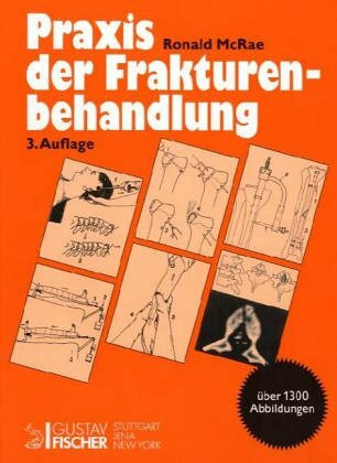 Praxis der Frakturenbehandlung
