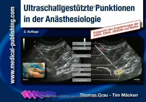 Ultraschallgestützte Punktionen in der Anästhesiologie