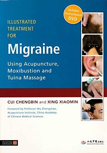 Illustrated Treatment for Migraine Using Acupuncture, Moxibustion and Tuina Massage