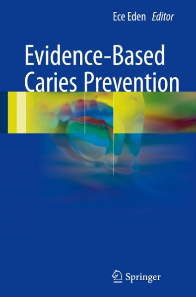 Evidence-Based Caries Prevention