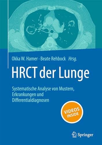 HRCT der Lunge: Systematische Analyse von Mustern, Erkrankungen und Differenzialdiagnosen
