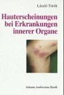 Hauterscheinungen bei Erkrankungen innerer Organe : mit 56 Tabellen. Hauterscheinungen bei Erkrankungen innerer Organe : mit 56 Tabellen.