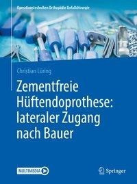 Zementfreie Hüftendoprothese: lateraler Zugang nach Bauer