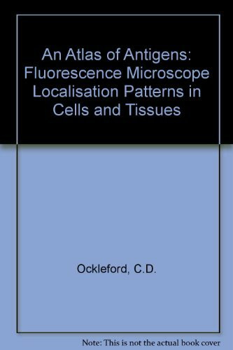 An Atlas of Antigens: Fluorescence Microscope Localisation Patterns in Cells and Tissues