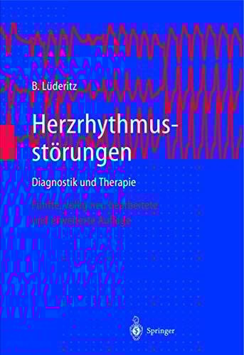 Herzrhythmusstörungen: Diagnostik und Therapie