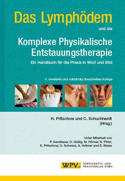 Das Lymphödem und die Komplexe Physikalische Entstauungstherapie: Ein Handbuch für die Praxis in Wort und Bild