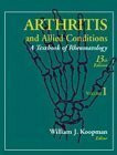 Arthritis and Allied Conditions: A Textbook of Rheumatology