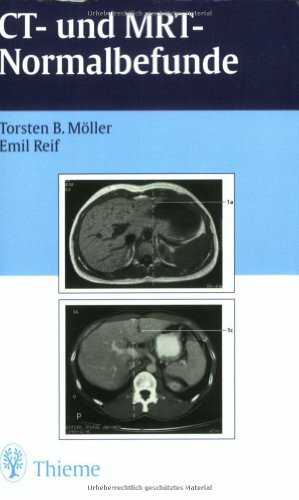 CT und MRT Normalbefunde