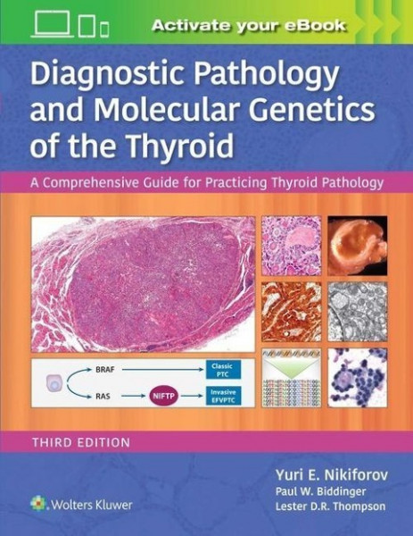 Nikiforov, Y: Diagnostic Pathology and Molecular Genetics of